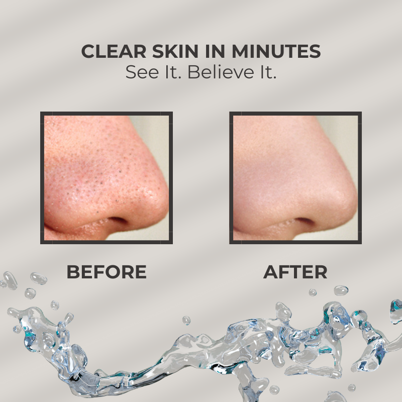 DeepClean Pore Cleaner – Hot & Cold Blackhead Remover with LED Light Therapy